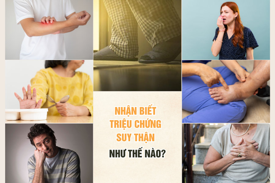 Nhận biết triệu chứng suy thận như thế nào?- Ảnh 2.