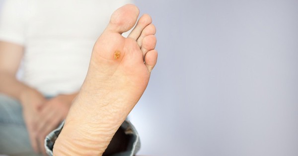 Vì sao người đái tháo đường bị mất cảm giác ở bàn chân và cách chăm sóc đúng