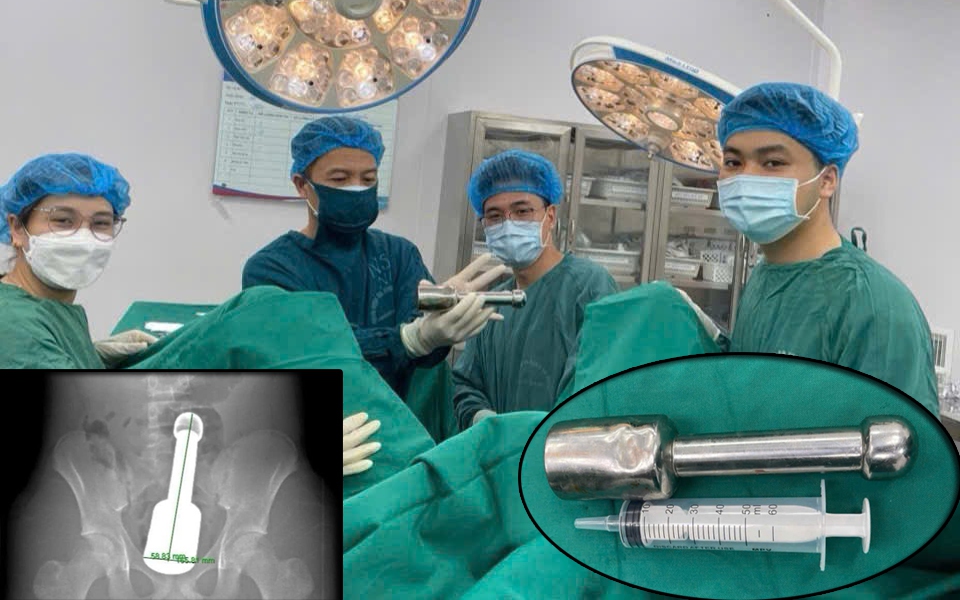 Tưởng viêm họng nhẹ, nữ sinh 16 tuổi nguy kịch do siêu vi khuẩn kháng thuốc tấn công - Ảnh 1.