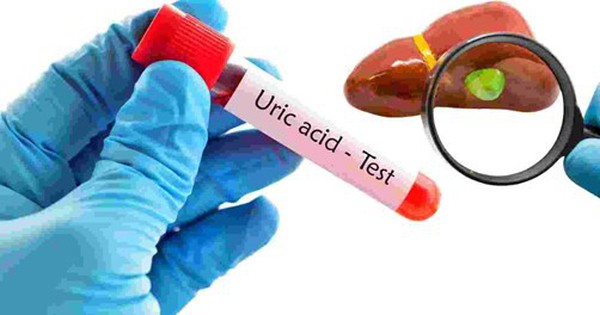 Cách dùng cần tây hỗ trợ giảm axit uric tại nhà: Lợi ích và những điều cần lưu ý