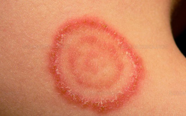 Cảnh giác nấm da lây từ chó, mèo