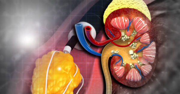Phát hiện loại thuốc mới đầy hứa hẹn trị bệnh thận hiếm nguy hiểm