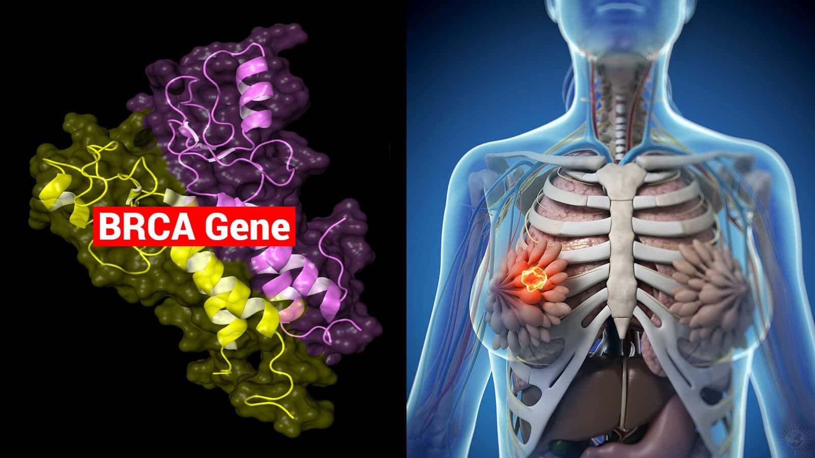 Mẹ mắc ung thư vú, con gái có bị không?- Ảnh 1. Mẹ mắc ung thư vú, con gái có bị không?- Ảnh 1.