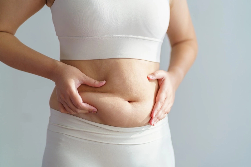 Vì sao người gầy vẫn có nhiều mỡ bụng?- Ảnh 1.