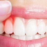 Nguyên nhân thường gặp gây chảy máu miệng và cách xử trí tại nhà