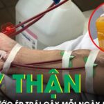 Uống nước ép trái cây mỗi ngày để thải độc, người đàn ông phải chạy thận định kỳ