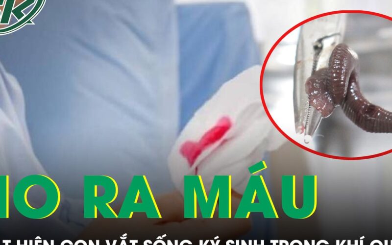 Ho ra máu suốt một tháng, bàng hoàng phát hiện con vắt sống ký sinh trong khí quản