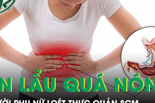 Người phụ nữ loét thực quản 8cm vì thói quen ăn lẩu quá nóng