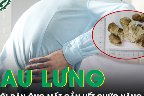 Người đàn ông mất gần hết chức năng thận do chủ quan với dấu hiệu đau lưng