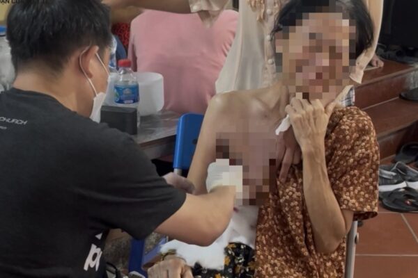 Chuyện rùng mình giữa Hà Nội: Tự ý ‘mổ’ khối u ngay tại cơ sở chữa bệnh bằng nước