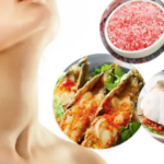 Nguyên tắc dinh dưỡng cho người mắc bệnh tuyến giáp