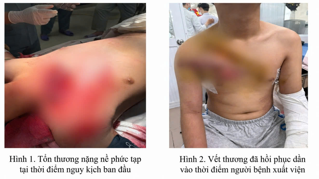 tai-nan-115-17786518185811608279007 Bộ đôi ‘báo động đỏ liên viện’ và bác sĩ luân phiên cứu nhiều ca nguy kịch ở TPHCM- Ảnh 2.