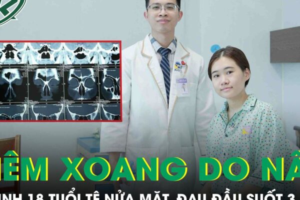 Viêm xoang do nấm, nữ sinh 18 tuổi tê nửa mặt, đau đầu suốt 3 năm