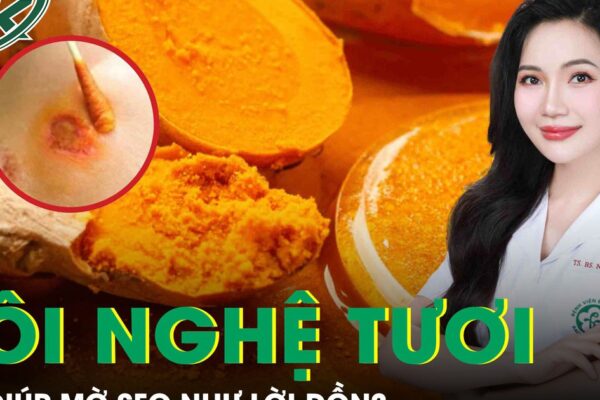 Dùng nghệ tươi bôi mặt có giúp mờ sẹo như lời đồn?