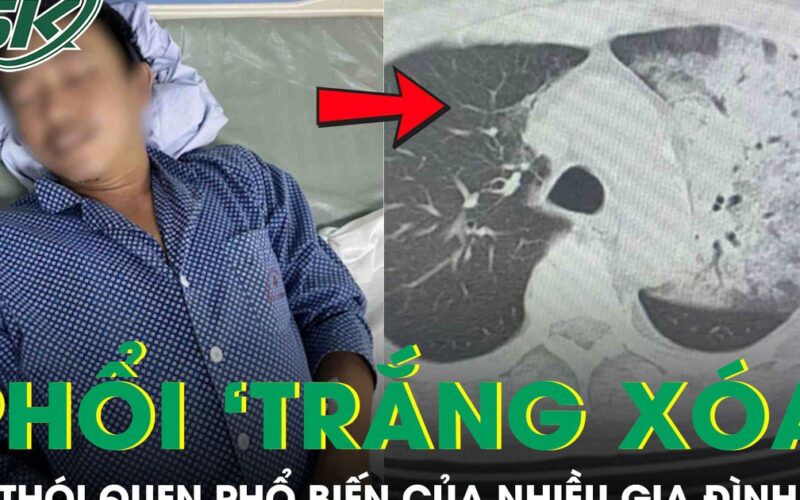 Tưởng cảm cúm, người đàn ông bất ngờ suy đa tạng, phổi ‘trắng xoá’ vì thói quen nhiều người mắc
