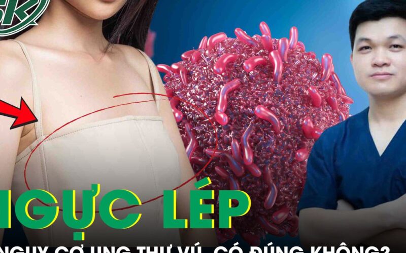 Phụ nữ ngực lép có ít nguy cơ bị ung thư vú hơn không?