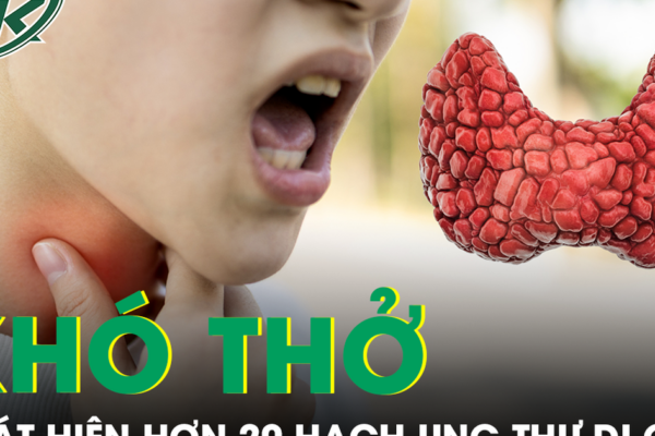 Khó thở mất tiếng, người phụ nữ phát hiện hơn 20 hạch ung thư di căn