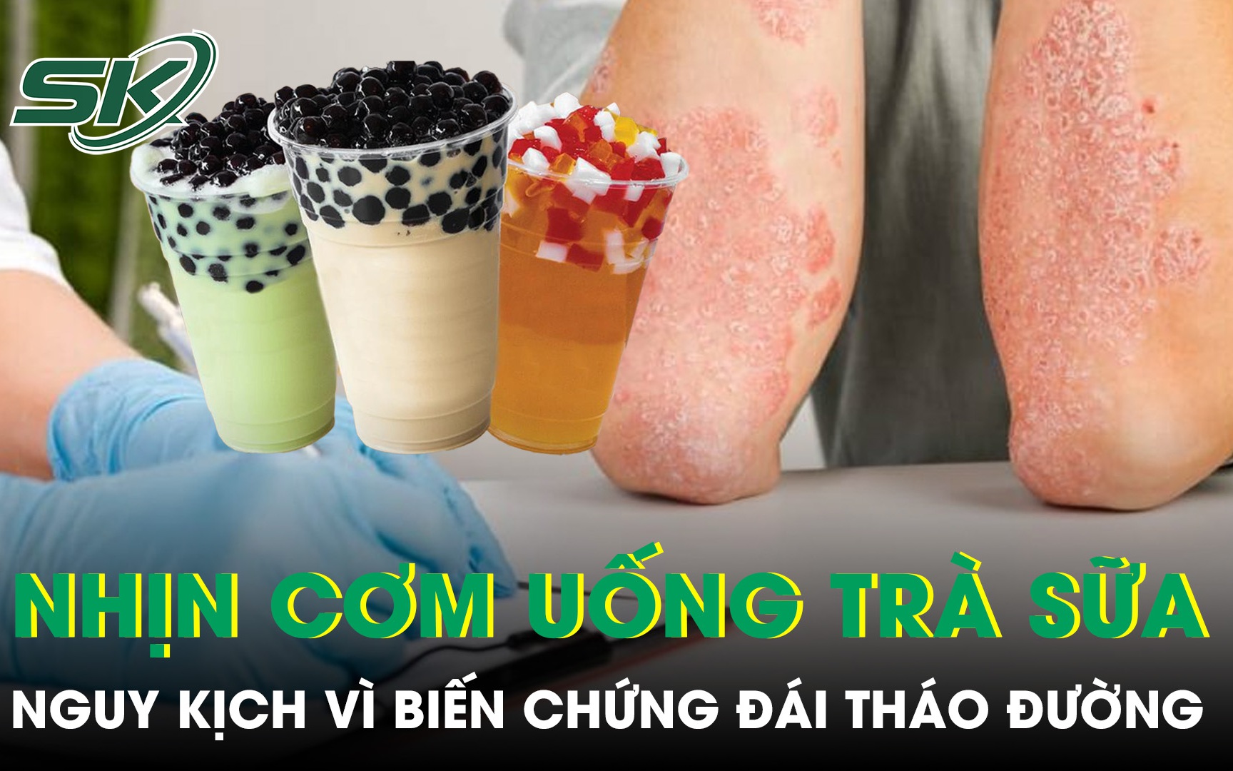 Người bệnh đái tháo đường kiêng gì để phòng ngừa biến chứng?- Ảnh 2.