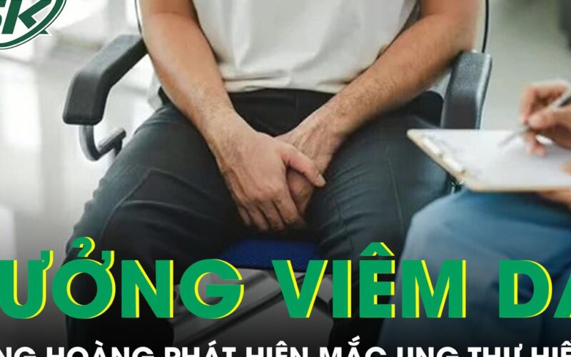 Tưởng viêm da vùng kín suốt 2 năm người đàn ông phát hiện mắc ung thư hiếm