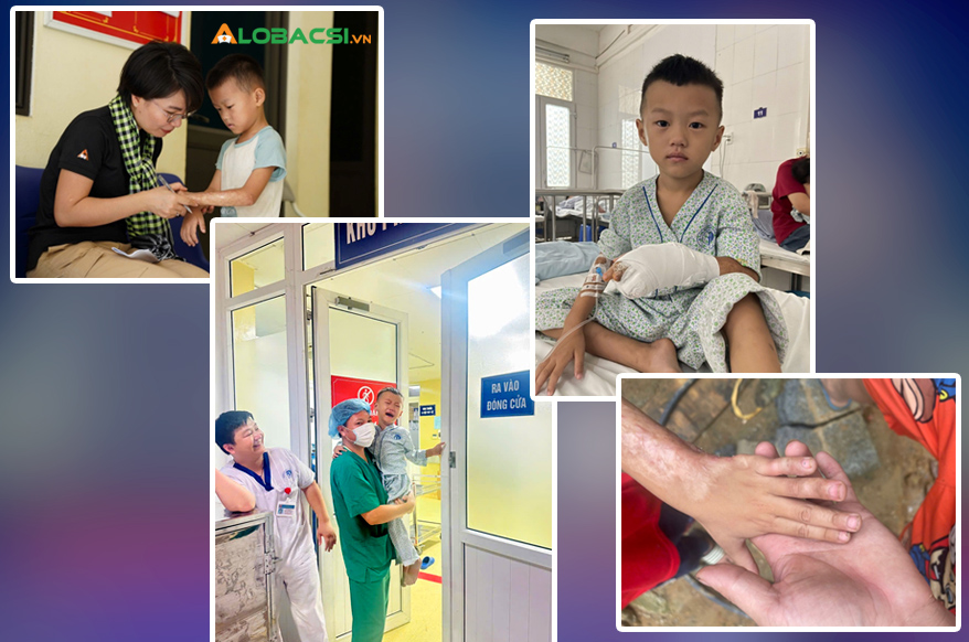6a0b51ee54733-1779156873965-17791568745011671978945 20 năm khoa Phẫu thuật tạo hình, Bệnh viện Xanh Pôn: Chữa lành khuyết hổng, rẽ hướng hàng vạn cuộc đời khiếm khuyết- Ảnh 4.