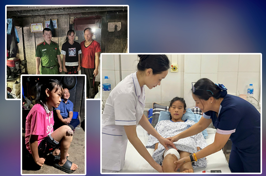 6a0b54a76460b-1779156877320-1779156877607767847910 20 năm khoa Phẫu thuật tạo hình, Bệnh viện Xanh Pôn: Chữa lành khuyết hổng, rẽ hướng hàng vạn cuộc đời khiếm khuyết- Ảnh 6.