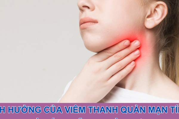 Ảnh hưởng của viêm thanh quản mạn tính và cách hỗ trợ cải thiện