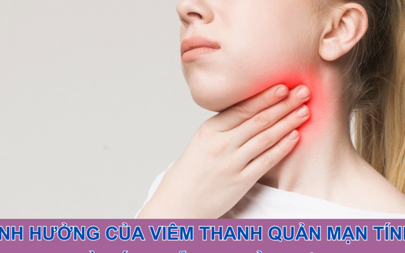 Ảnh hưởng của viêm thanh quản mạn tính và cách hỗ trợ cải thiện