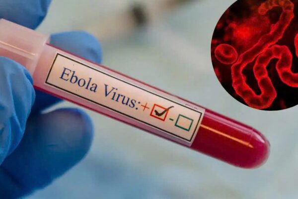 Dịch bệnh Ebola diễn biến phức tạp tại Châu Phi nhưng người dân không nên hoang mang