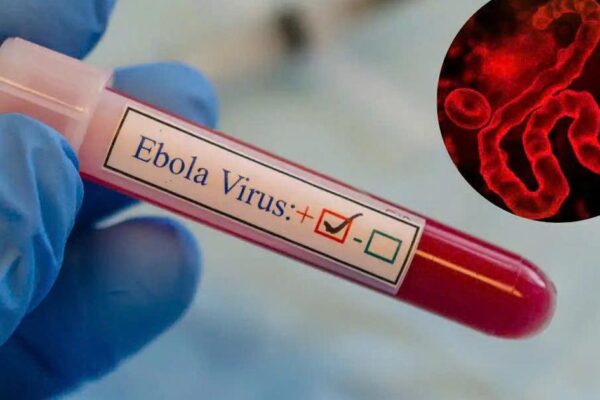 WHO cảnh báo khẩn về Ebola, Bộ Y tế yêu cầu tăng cường giám sát, ngăn dịch xâm nhập