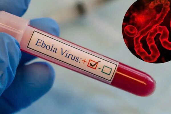 TPHCM tăng cường giám sát trước nguy cơ dịch Ebola xâm nhập