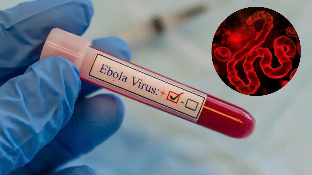 ebola-anh-minh-hoa-17791576352571070848441 TPHCM tăng cường giám sát trước nguy cơ dịch Ebola xâm nhập- Ảnh 1.