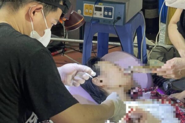 Vụ ông Nguyễn Tiến Nam: Bác sĩ nói gì về việc tự ý mổ u bằng dao điện cao tần?