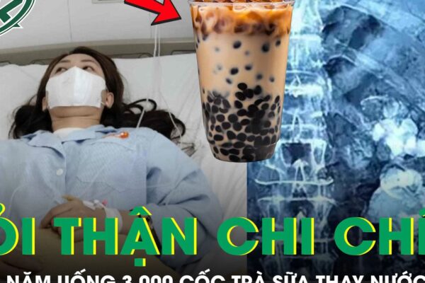 Uống 3.000 cốc trà sữa thay nước lọc suốt 9 năm, thận cô gái mọc chi chít sỏi