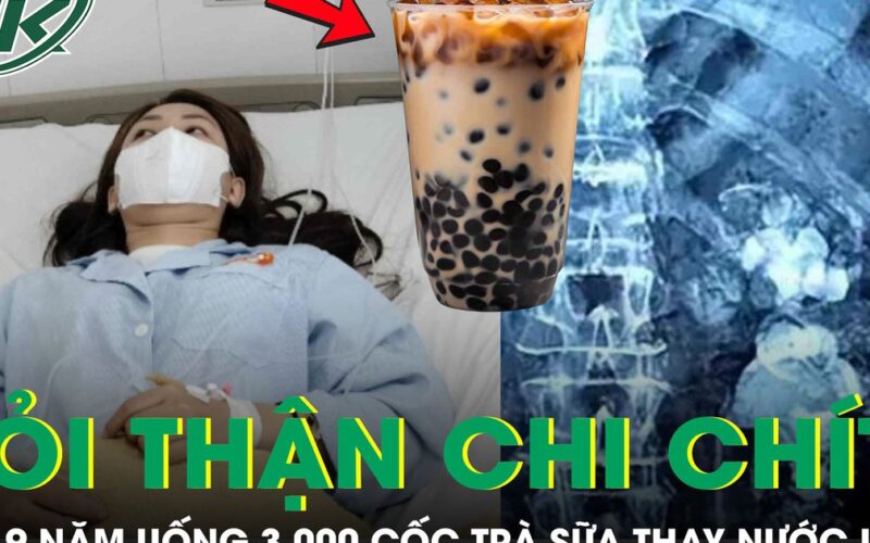 Uống 3.000 cốc trà sữa thay nước lọc suốt 9 năm, thận cô gái mọc chi chít sỏi
