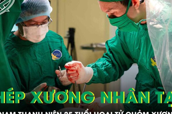 Ghép xương nhân tạo cho nam thanh niên 25 tuổi bị hoại tử chỏm xương đùi