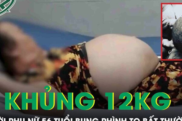 Bụng to bất thường, người phụ nữ ‘khóc ngất’ khi phát hiện khối u khổng lồ nặng tới 12kg