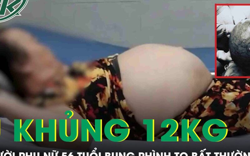 Bụng to bất thường, người phụ nữ ‘khóc ngất’ khi phát hiện khối u khổng lồ nặng tới 12kg