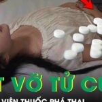 Thai phụ 31 tuần suýt vỡ tử cung vì uống 20 viên thuốc phá thai
