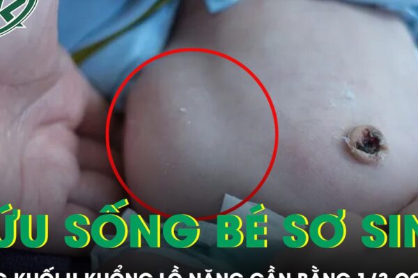 Cứu sống bé sơ sinh mang khối u khổng lồ nặng gần bằng 1/3 cơ thể